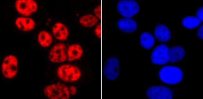 Phospho-RNA pol II CTD (Ser2) Antibody in Immunocytochemistry (ICC/IF)