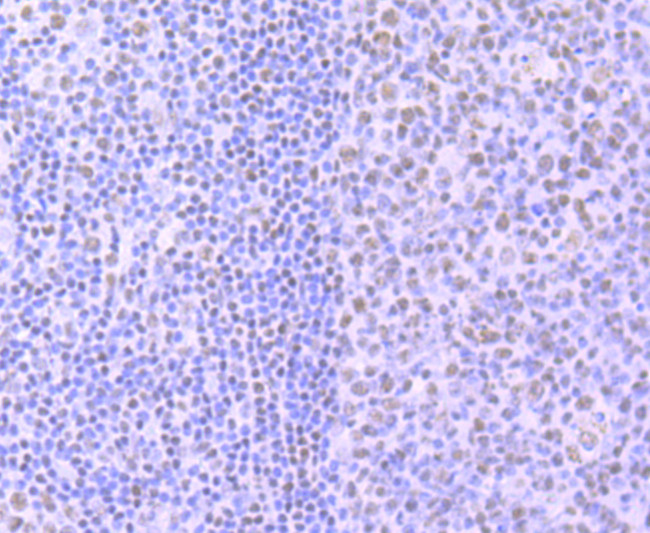 Phospho-RNA pol II CTD (Ser2) Antibody in Immunohistochemistry (Paraffin) (IHC (P))