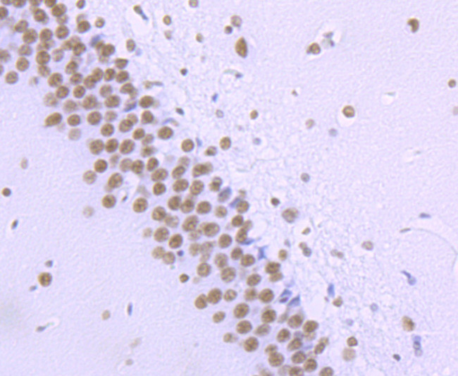 Phospho-RNA pol II CTD (Ser2) Antibody in Immunohistochemistry (Paraffin) (IHC (P))