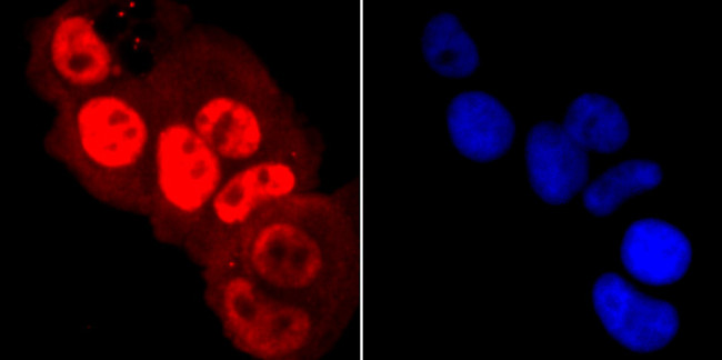 Phospho-RNA pol II CTD (Ser5) Antibody in Immunocytochemistry (ICC/IF)