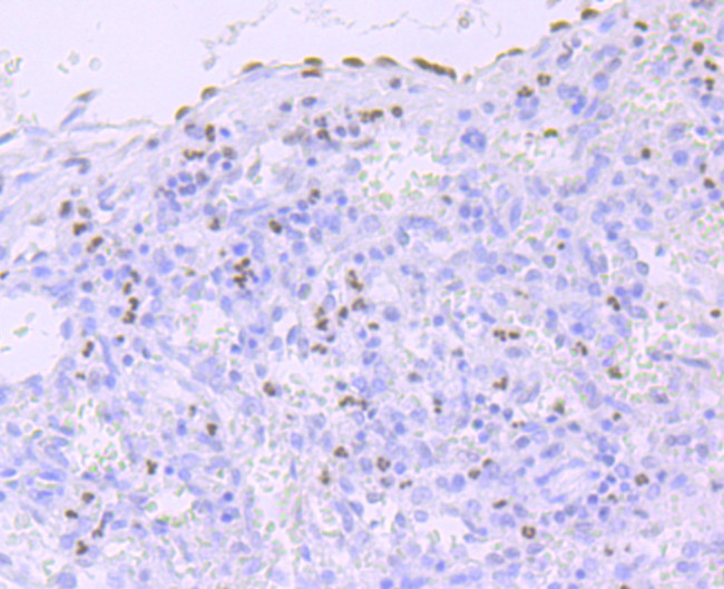 Phospho-RNA pol II CTD (Ser5) Antibody in Immunohistochemistry (Paraffin) (IHC (P))