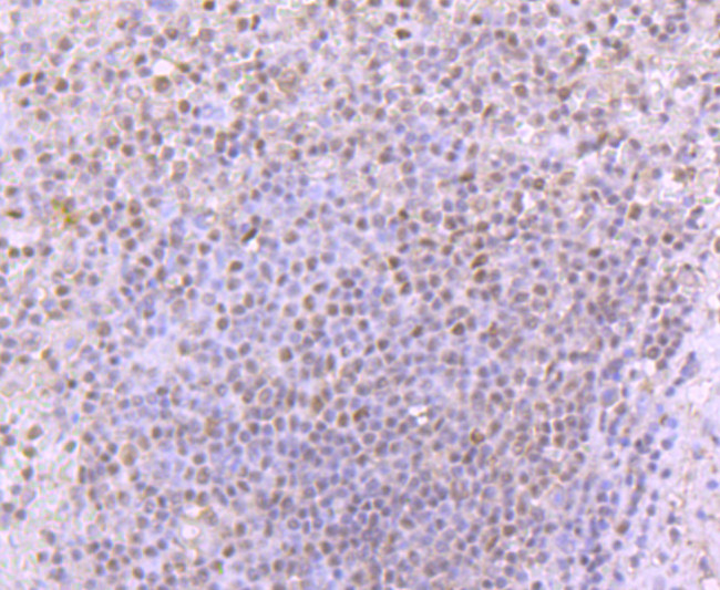 53BP1 Antibody in Immunohistochemistry (Paraffin) (IHC (P))