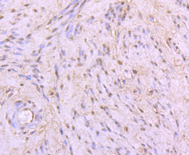 53BP1 Antibody in Immunohistochemistry (Paraffin) (IHC (P))