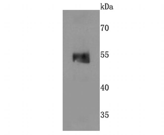 MINA53 Antibody in Western Blot (WB)