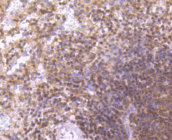 ITGA4 Antibody in Immunohistochemistry (Paraffin) (IHC (P))