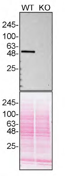 CaMKII delta Antibody in Western Blot (WB)