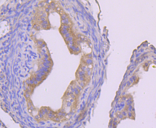 IKK gamma Antibody in Immunohistochemistry (Paraffin) (IHC (P))