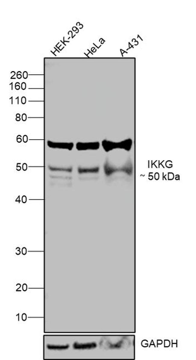 IKK gamma Recombinant Monoclonal Antibody (JA11-83) (MA5-32682)