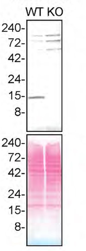 Profilin 1 Antibody in Western Blot (WB)