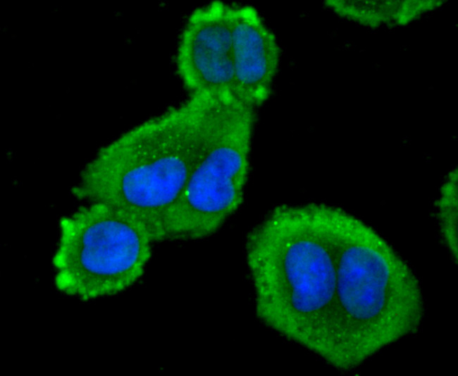 Profilin 1 Antibody in Immunocytochemistry (ICC/IF)