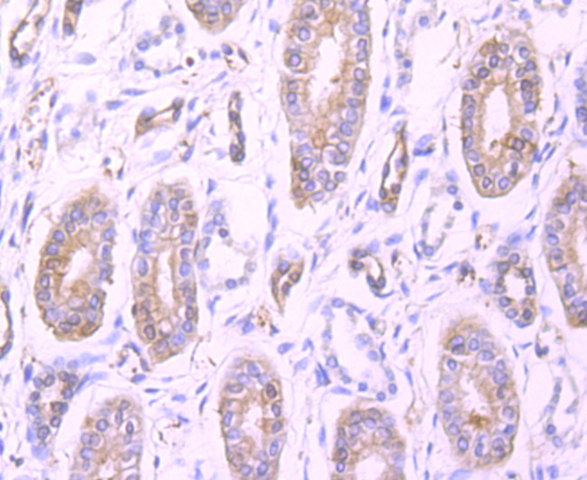 Profilin 1 Antibody in Immunohistochemistry (Paraffin) (IHC (P))