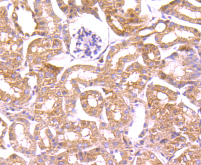 Profilin 1 Antibody in Immunohistochemistry (Paraffin) (IHC (P))