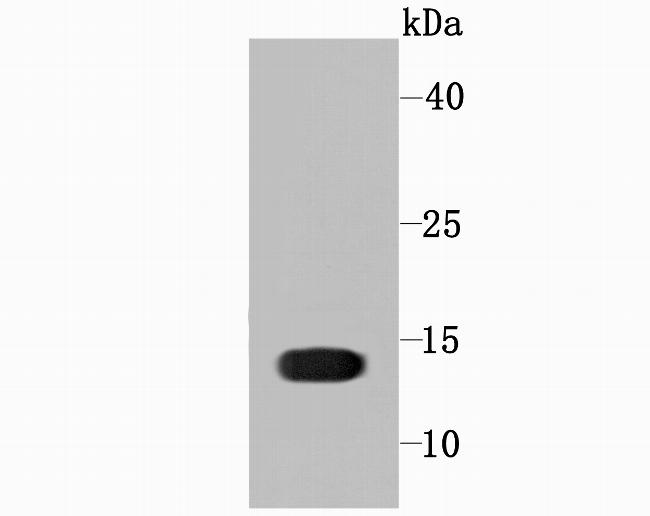 Profilin 1 Antibody in Western Blot (WB)