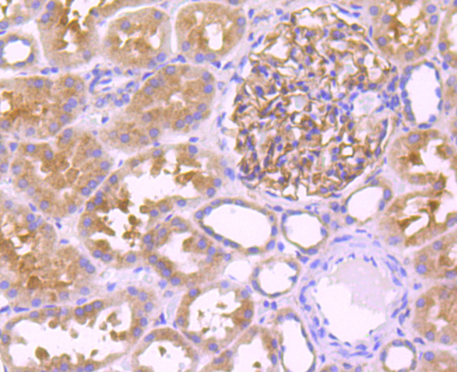 Leptin Receptor Antibody in Immunohistochemistry (Paraffin) (IHC (P))