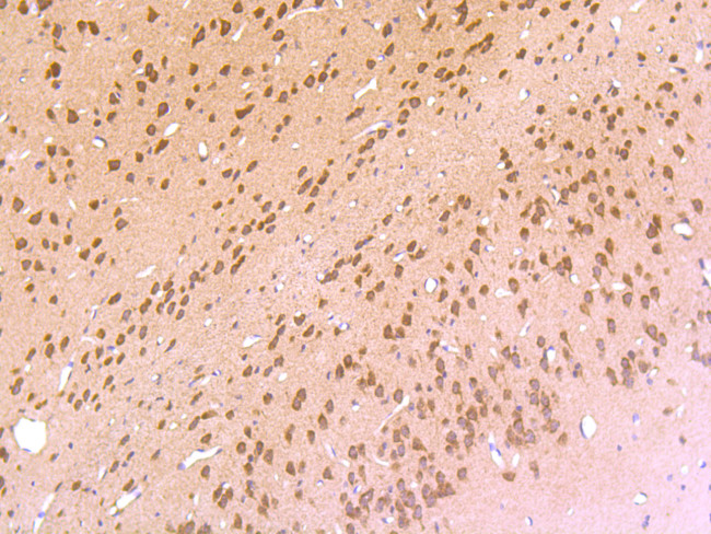 HTR2C Antibody in Immunohistochemistry (Paraffin) (IHC (P))