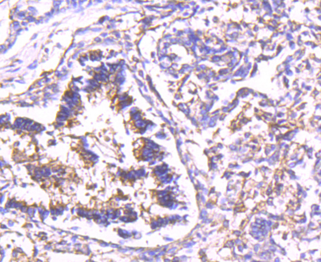 Calpain 2 Antibody in Immunohistochemistry (Paraffin) (IHC (P))