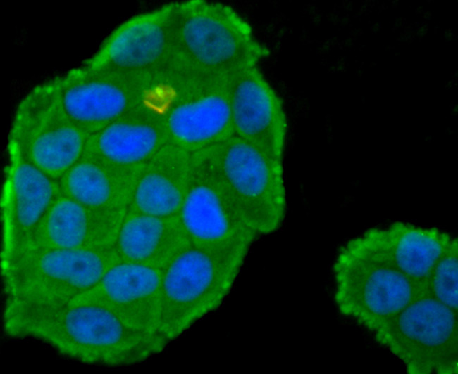 Protein C Antibody in Immunocytochemistry (ICC/IF)