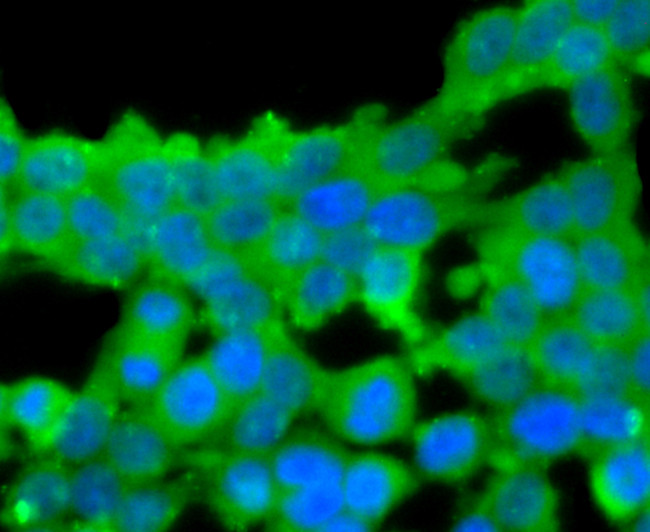 Protein C Antibody in Immunocytochemistry (ICC/IF)