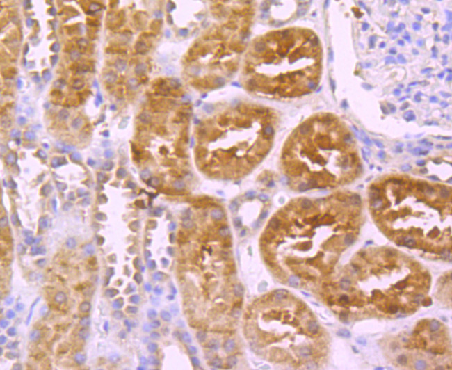 Protein C Antibody in Immunohistochemistry (Paraffin) (IHC (P))