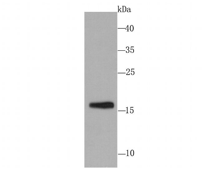 SKP1 Antibody in Western Blot (WB)
