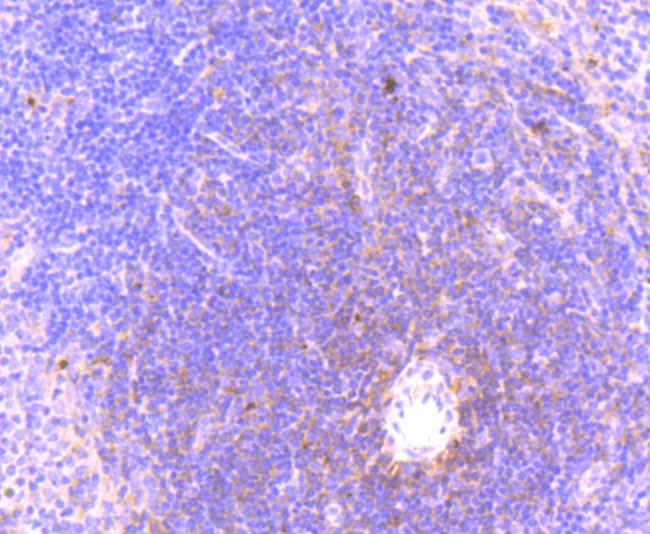 Phospho-MLKL (Ser345) Recombinant Monoclonal Antibody (JM92-37