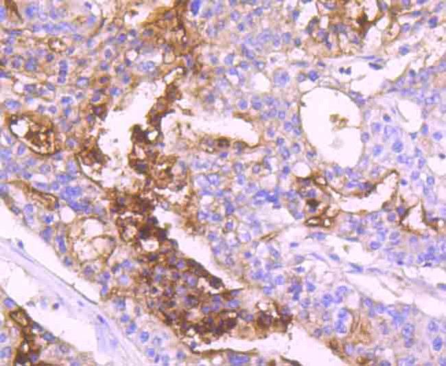 CD66e (CEA) Antibody in Immunohistochemistry (Paraffin) (IHC (P))