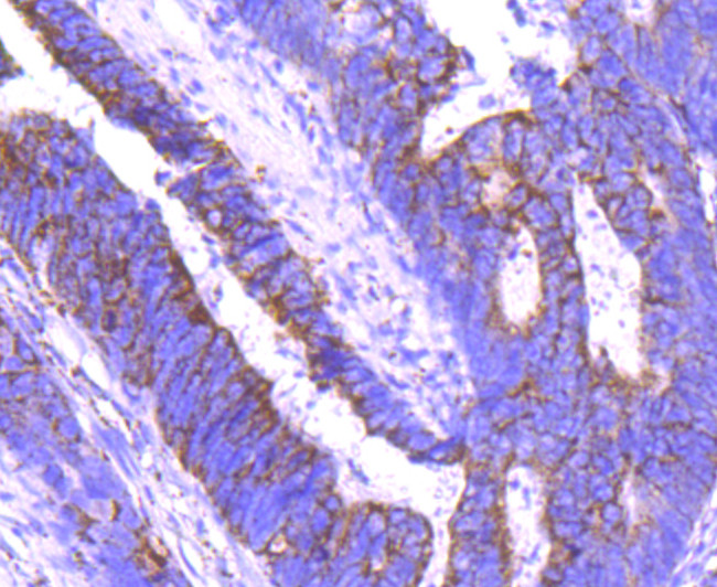 Angiopoietin 2 Antibody in Immunohistochemistry (Paraffin) (IHC (P))