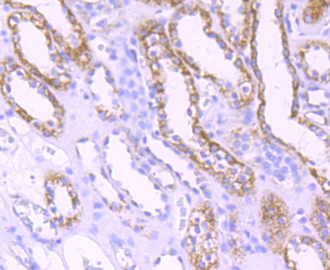 TFAM Antibody in Immunohistochemistry (Paraffin) (IHC (P))