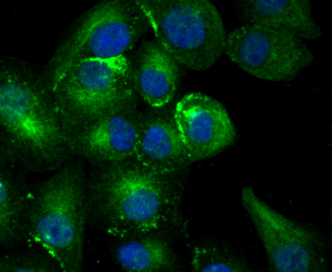 TFF1 Antibody in Immunocytochemistry (ICC/IF)