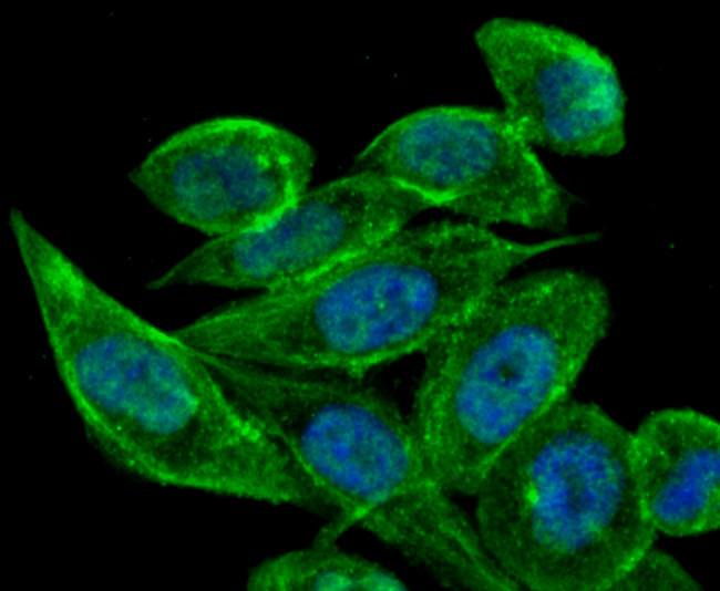 TFF1 Antibody in Immunocytochemistry (ICC/IF)