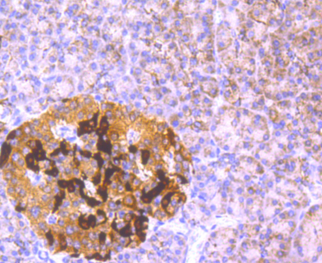 GCLM Antibody in Immunohistochemistry (Paraffin) (IHC (P))