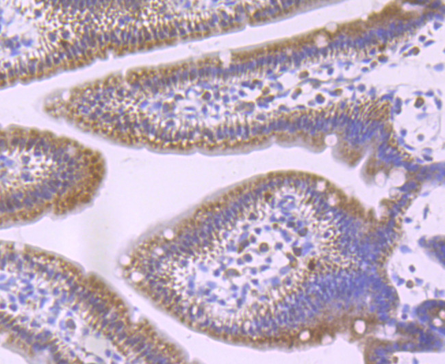 GCLM Antibody in Immunohistochemistry (Paraffin) (IHC (P))