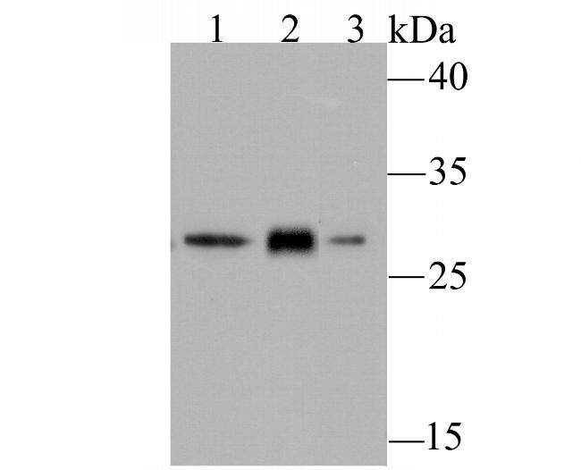 GCLM Antibody in Western Blot (WB)