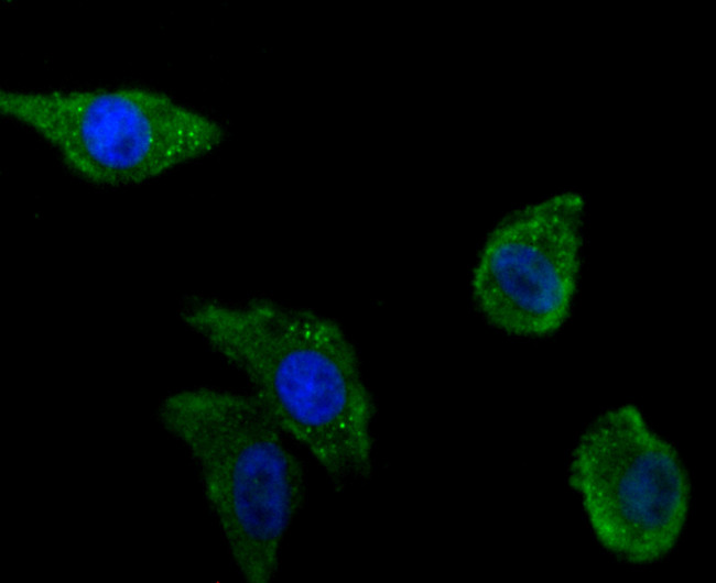 Zyxin Recombinant Rabbit Monoclonal Antibody (JU83-12)