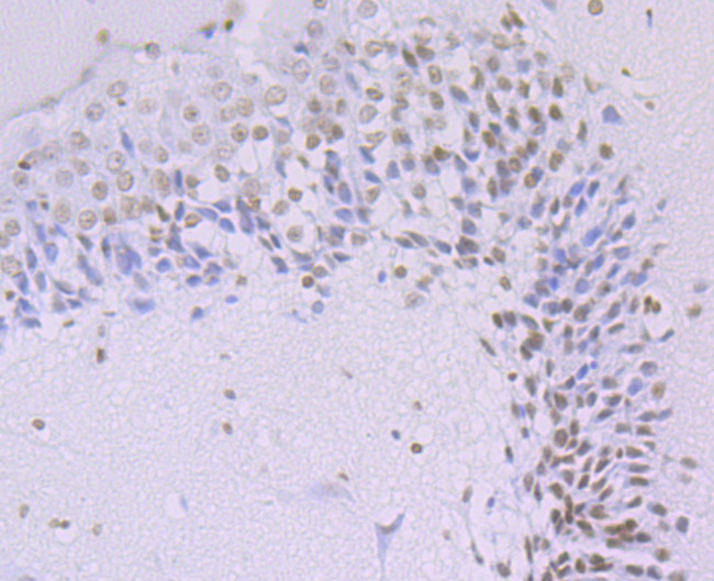 H3K14ac Antibody in Immunohistochemistry (Paraffin) (IHC (P))