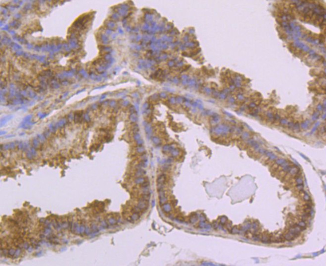 USP14 Antibody in Immunohistochemistry (Paraffin) (IHC (P))