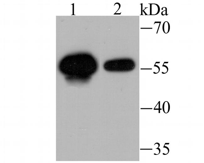 USP14 Antibody in Western Blot (WB)