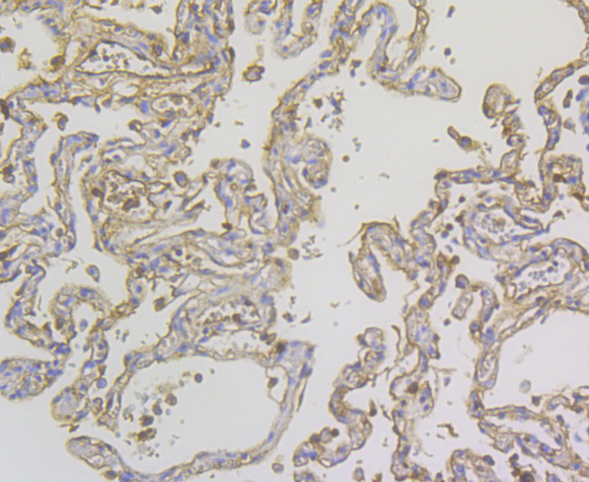 ORM1 Antibody in Immunohistochemistry (Paraffin) (IHC (P))