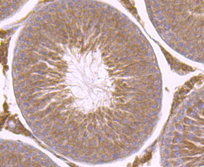 B-Raf Antibody in Immunohistochemistry (Paraffin) (IHC (P))