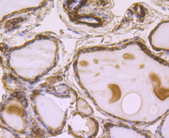 B-Raf Antibody in Immunohistochemistry (Paraffin) (IHC (P))