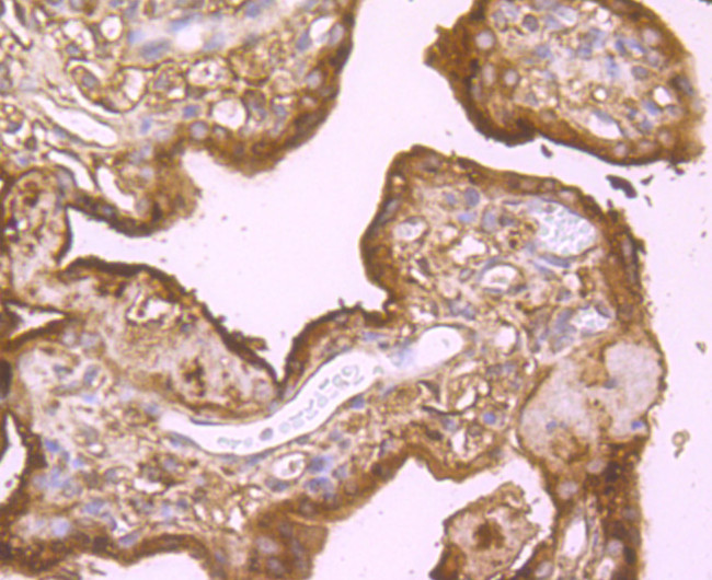 B-Raf Antibody in Immunohistochemistry (Paraffin) (IHC (P))