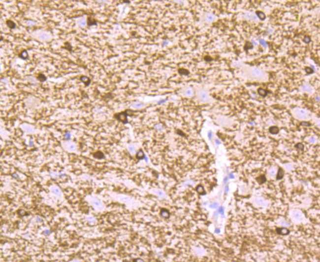 B-Raf Antibody in Immunohistochemistry (Paraffin) (IHC (P))