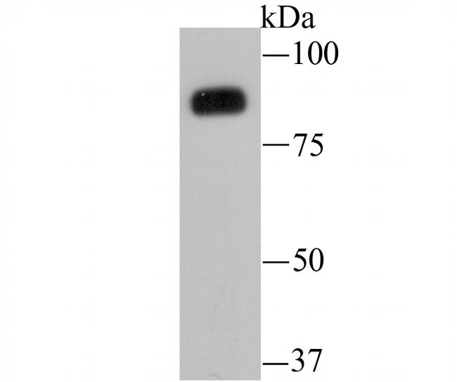 B-Raf Antibody in Western Blot (WB)