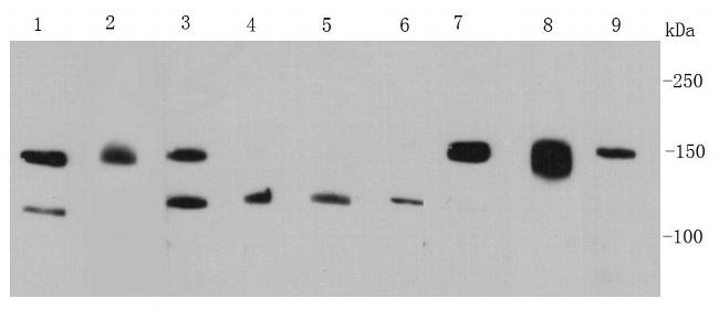 FGFR2 Antibody in Western Blot (WB)