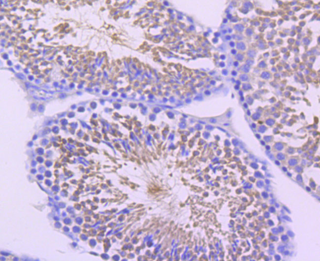 DNAI1 Antibody in Immunohistochemistry (Paraffin) (IHC (P))