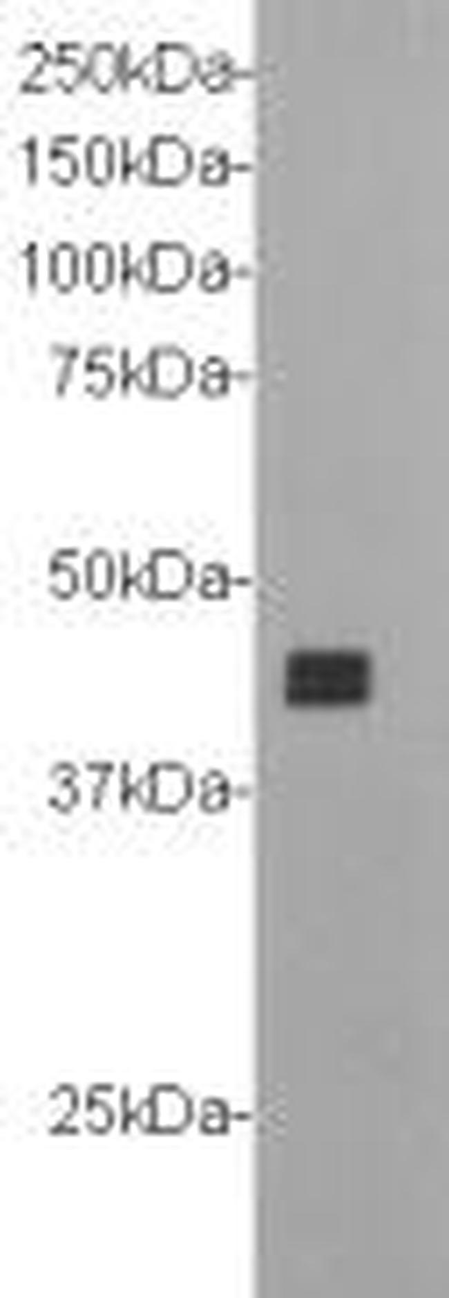 CD304 (Neuropilin-1) Antibody in Western Blot (WB)