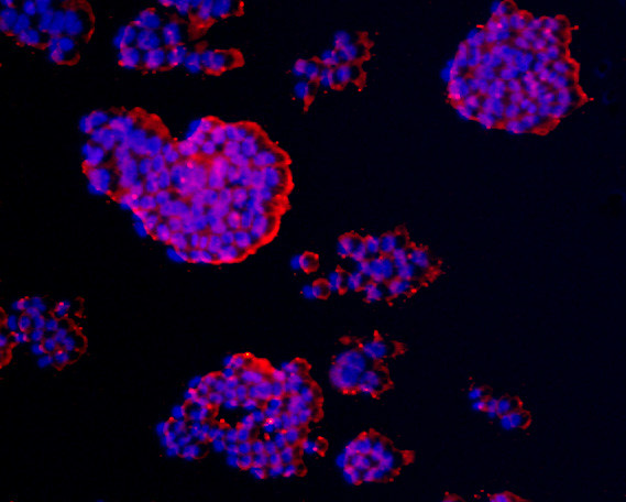 CCDC47 Antibody in Immunocytochemistry (ICC/IF)