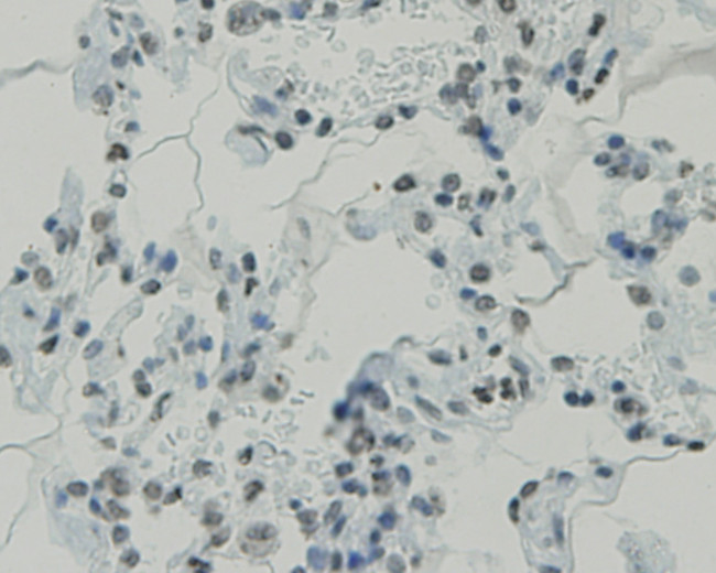 CCDC47 Antibody in Immunohistochemistry (Paraffin) (IHC (P))