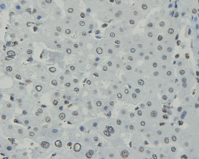 CCDC47 Antibody in Immunohistochemistry (Paraffin) (IHC (P))