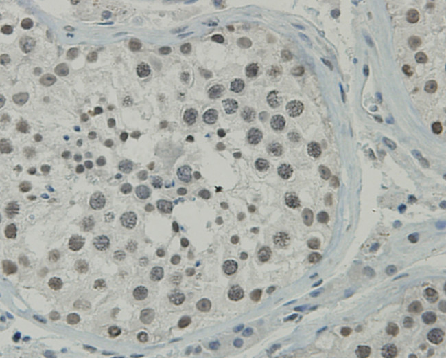 CCDC47 Antibody in Immunohistochemistry (Paraffin) (IHC (P))